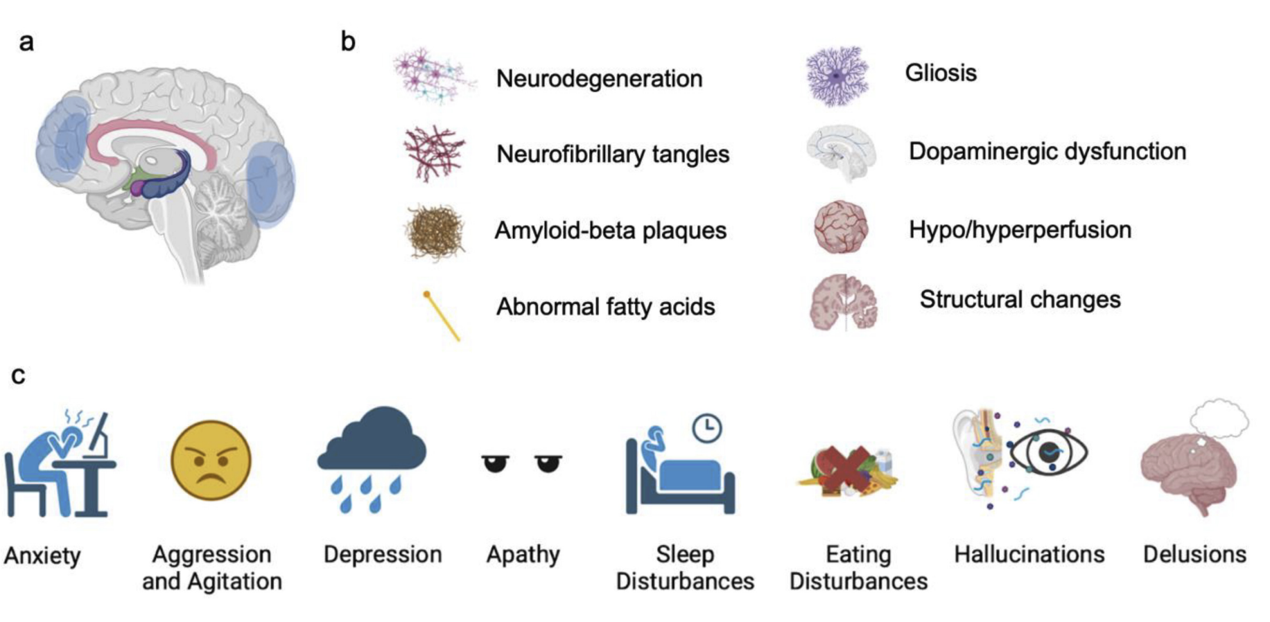 Zhang Zhang 2024 Frontiers Aging Neuroscience